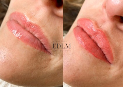 Fotos del antes y después acuarela lips