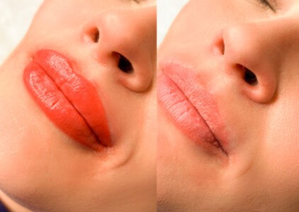 Fotos del antes y después acuarela lips